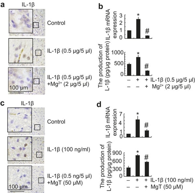 MgT treatment diminished the effects of IL-1β in the CSF of mice